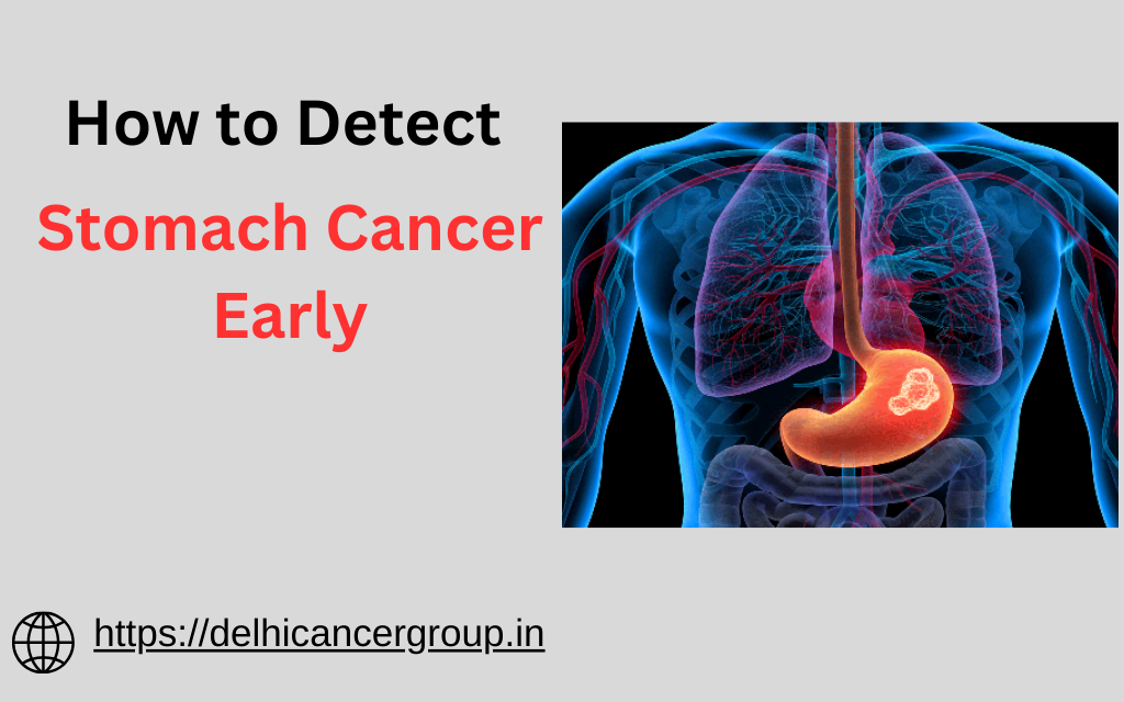 How to Detect Stomach Cancer Early: Key Steps & Symptoms